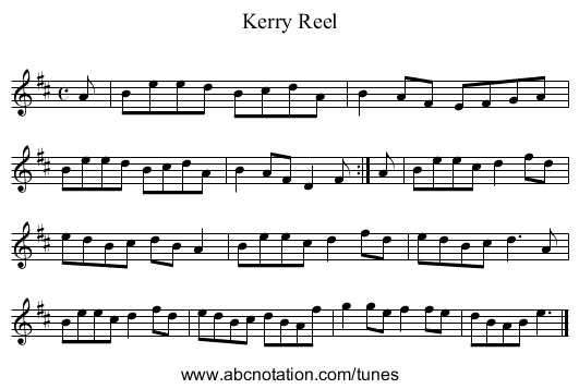 Kerry Reel - staff notation