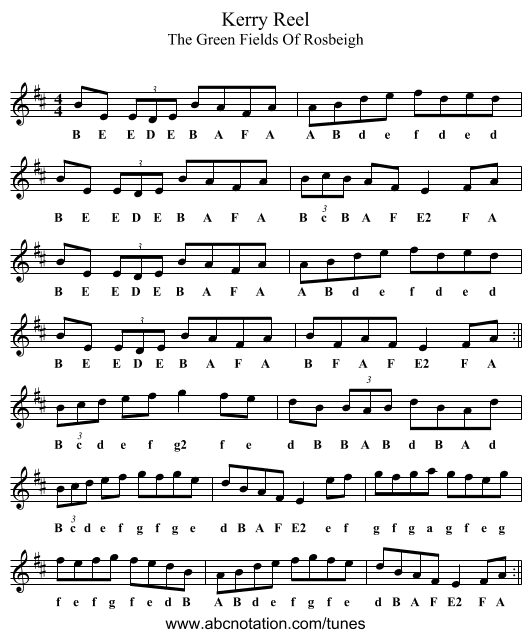 Kerry Reel - staff notation