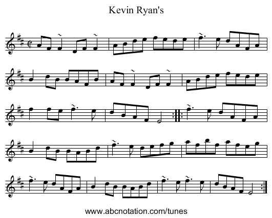 Kevin Ryan's - staff notation