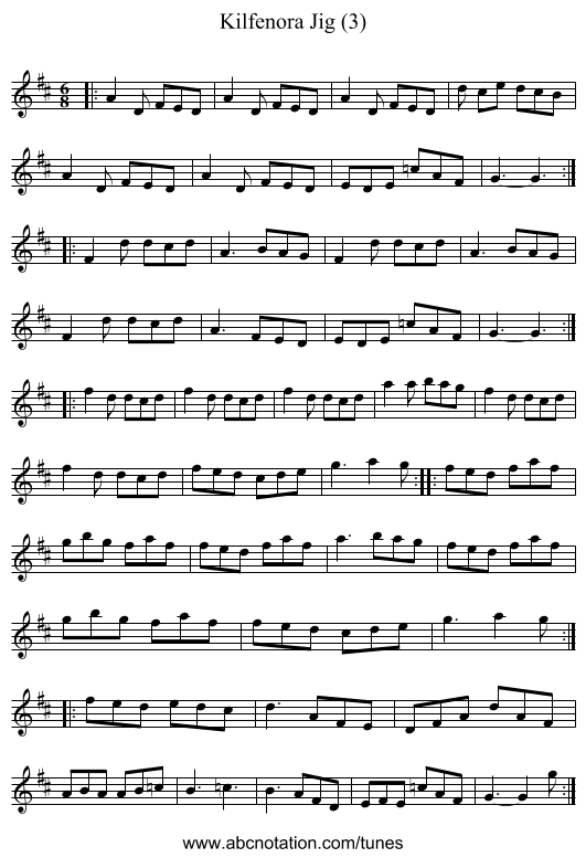 Kilfenora Jig (3) - staff notation