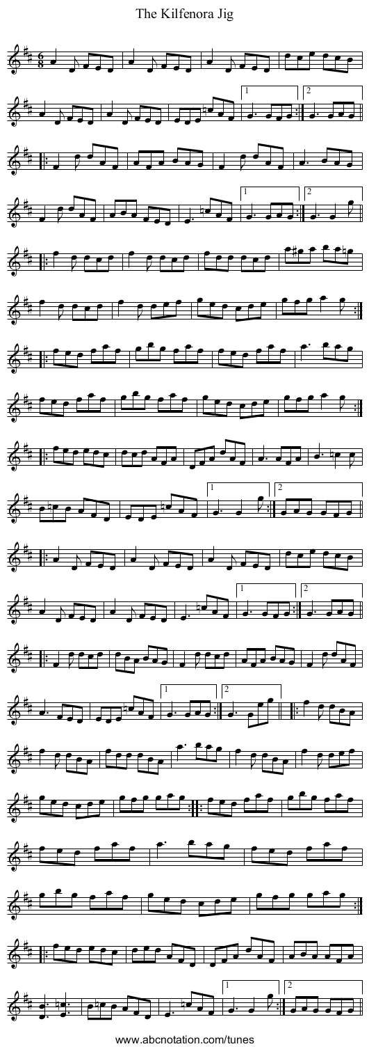 Kilfenora Jig, The - staff notation