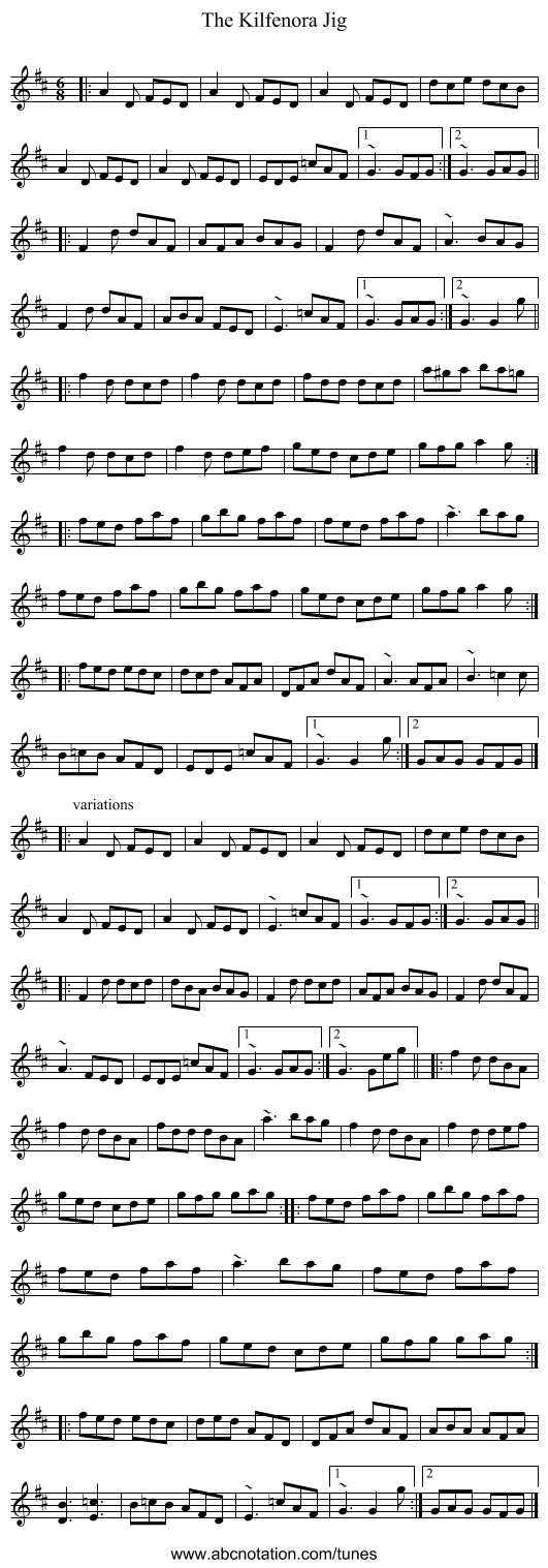 Kilfenora Jig, The - staff notation