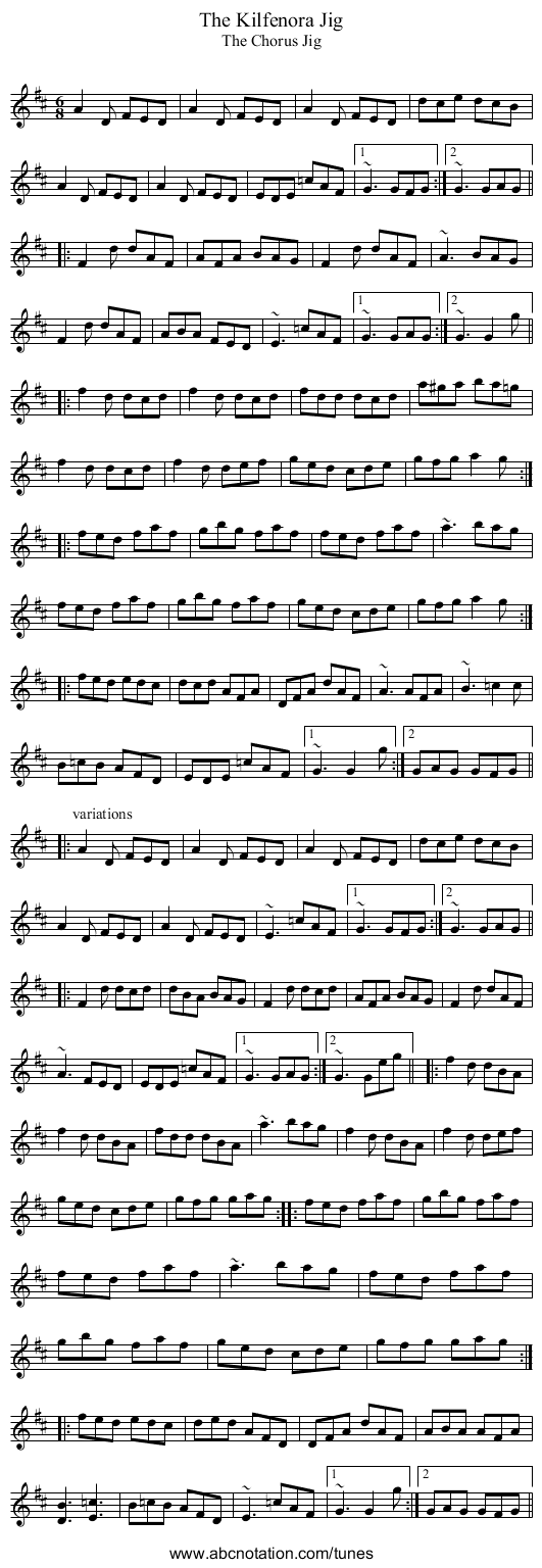 Kilfenora Jig, The - staff notation