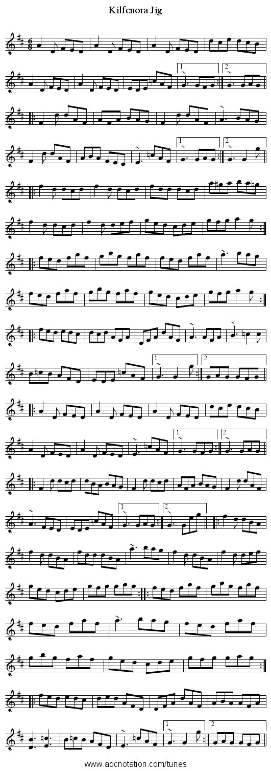 Kilfenora Jig - staff notation