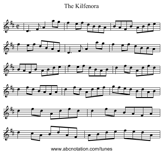 Kilfenora, The - staff notation