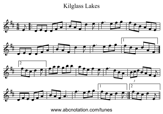 Kilglass Lakes - staff notation