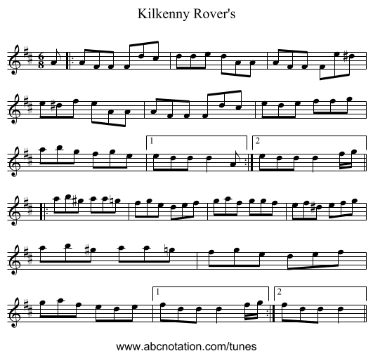 Kilkenny Rover's - staff notation
