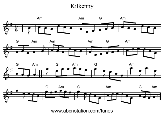 Kilkenny - staff notation