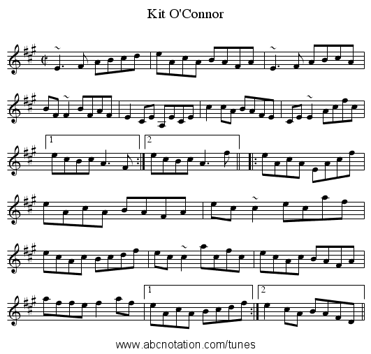 Kit O'Connor - staff notation