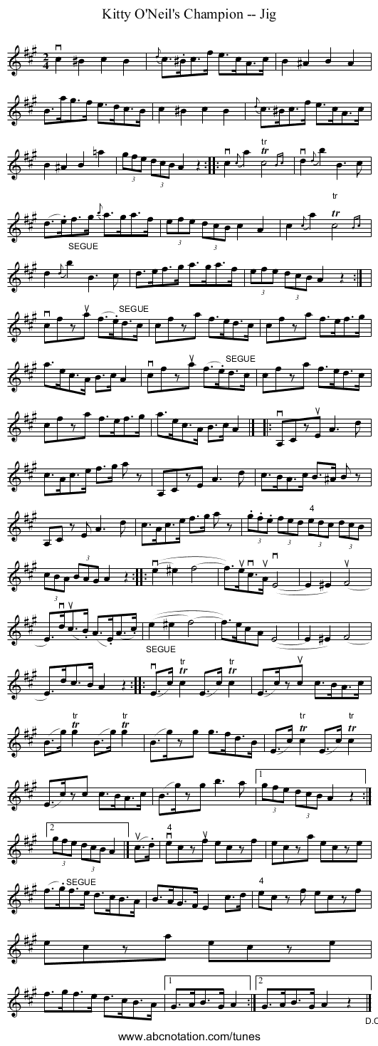 Kitty O'Neil's Champion -- Jig - staff notation