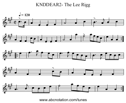KNDDEAR2- The Lee Rigg - staff notation