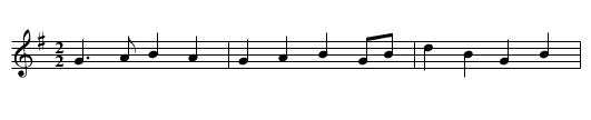 Knifes Edge - staff notation