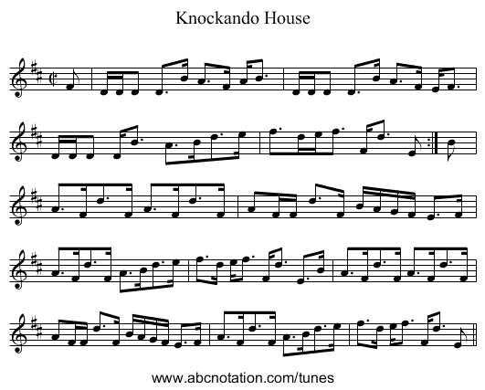 Knockando House - staff notation