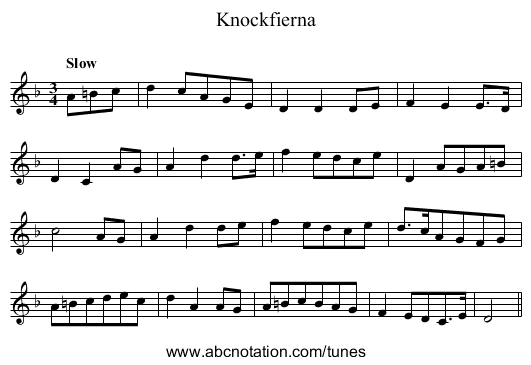 Knockfierna - staff notation