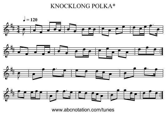 KNOCKLONG POLKA* - staff notation