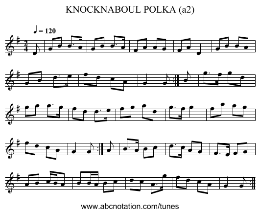 KNOCKNABOUL POLKA (a2) - staff notation
