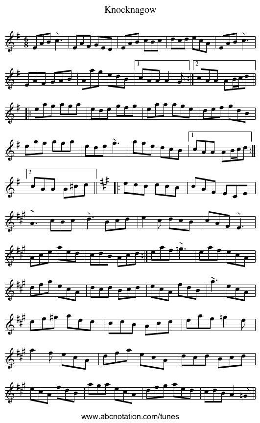 Knocknagow - staff notation