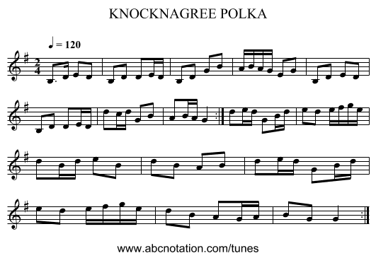 KNOCKNAGREE POLKA - staff notation