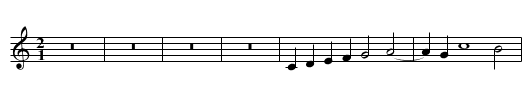 La Bernardina - staff notation