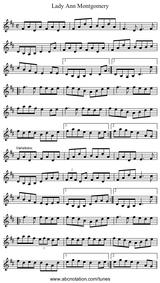 Lady Ann Montgomery - staff notation