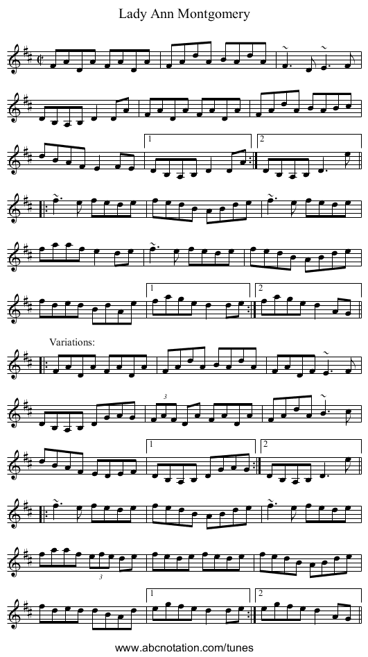 Lady Ann Montgomery - staff notation