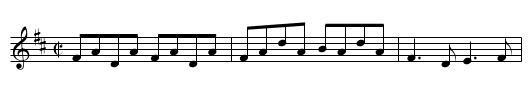Lady Ann Montgomery - staff notation