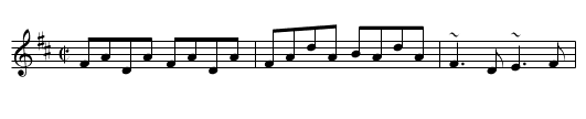 Lady Ann Montgomery - staff notation
