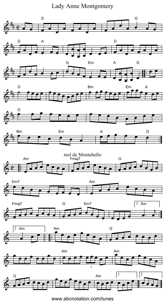 Lady Anne Montgomery - staff notation