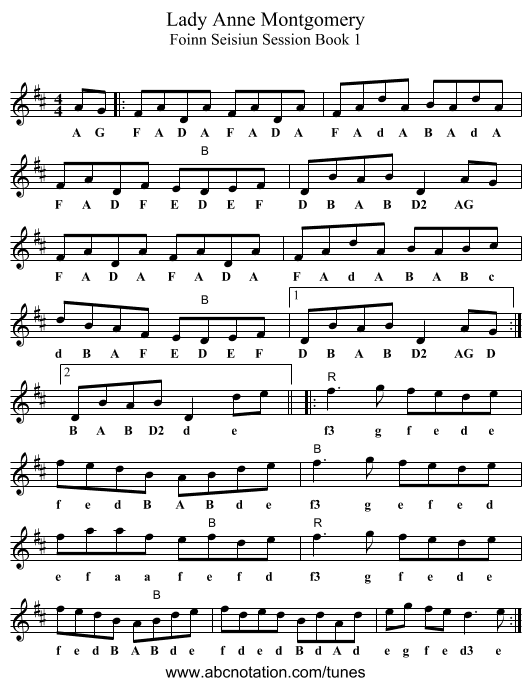 Lady Anne Montgomery - staff notation