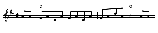 Lady Anne Montgomery - staff notation