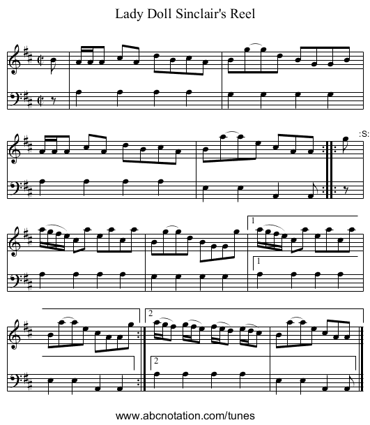 Lady Doll Sinclair's Reel - staff notation
