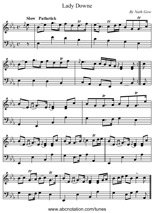Lady Downe - staff notation