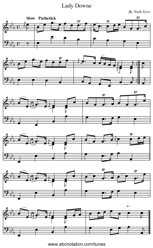 Lady Downe - staff notation
