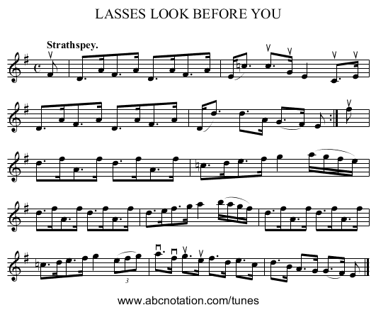 LASSES LOOK BEFORE YOU - staff notation