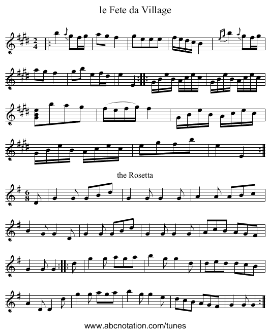 le Fete da Village - staff notation