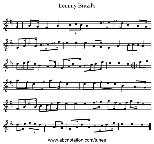 Lemmy Brazil's - staff notation