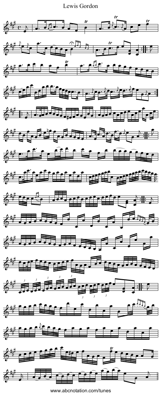 Lewis Gordon - staff notation