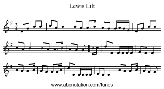 Lewis Lilt - staff notation
