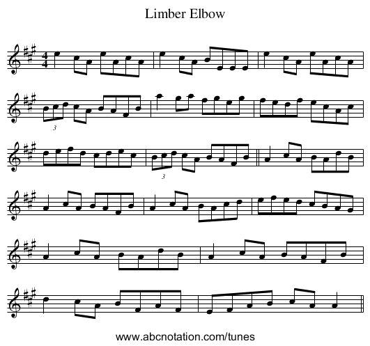 Limber Elbow - staff notation