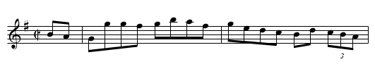 Liverpool Breakdown - staff notation