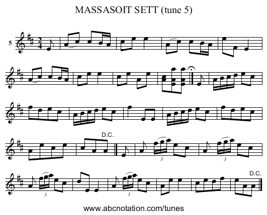 MASSASOIT SETT (tune 5) - staff notation