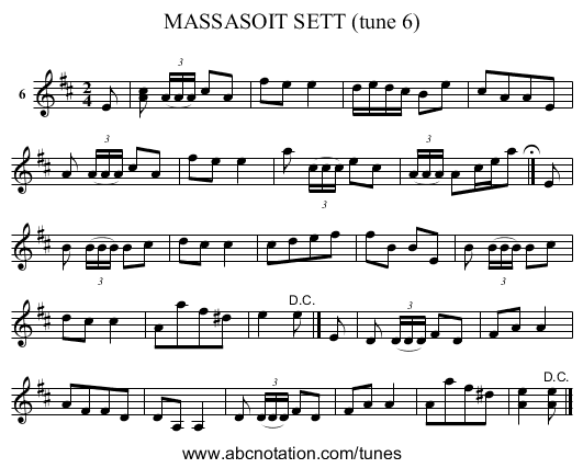 MASSASOIT SETT (tune 6) - staff notation
