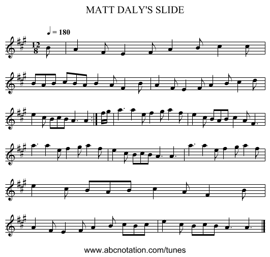 MATT DALY'S SLIDE - staff notation
