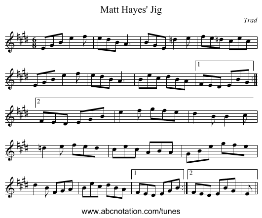 Matt Hayes' Jig - staff notation