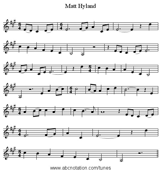 Matt Hyland - staff notation