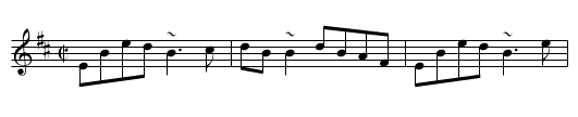 McFadden's Reel - staff notation
