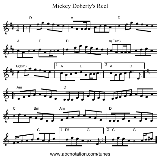 Mickey Doherty's Reel - staff notation