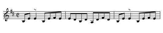 Miss Patterson's Slipper - staff notation