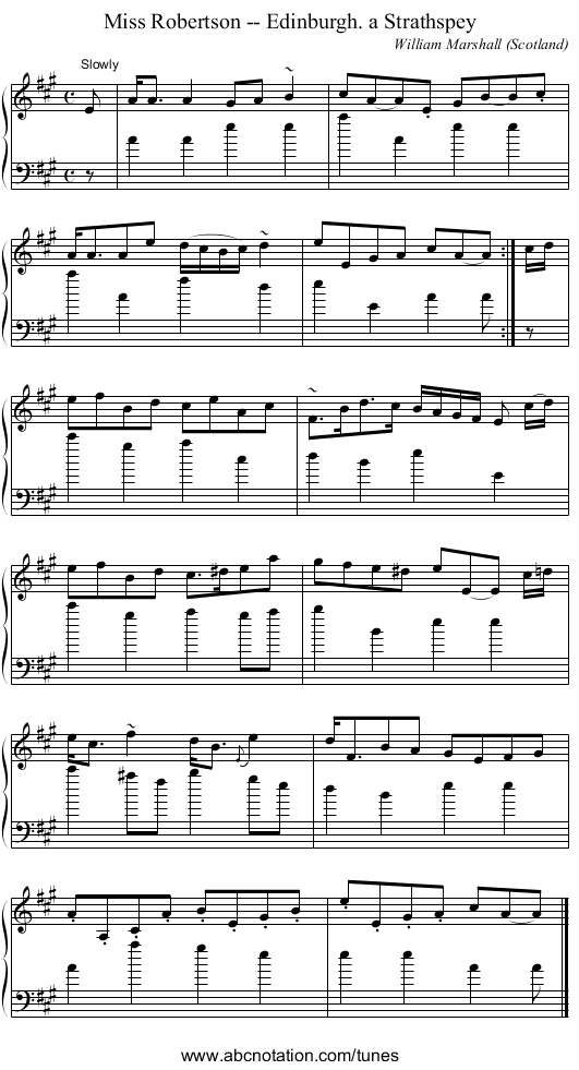 Miss Robertson -- Edinburgh. a Strathspey - staff notation