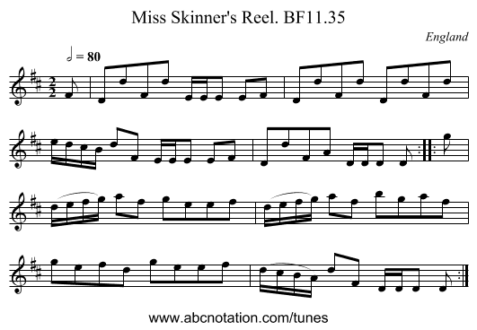 Miss Skinner's Reel. BF11.35 - staff notation